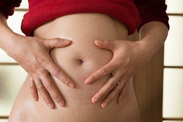 産後 妊娠線